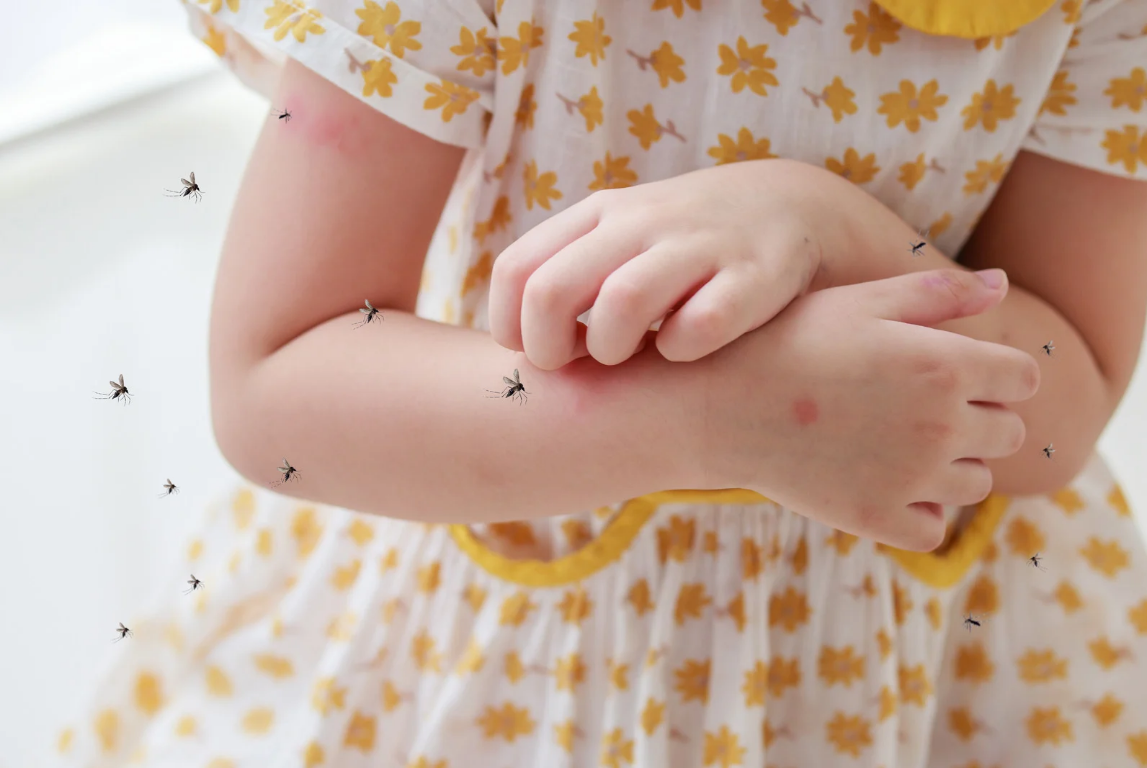 Gigitan nyamuk yang bisa menyebabkan demam berdarah