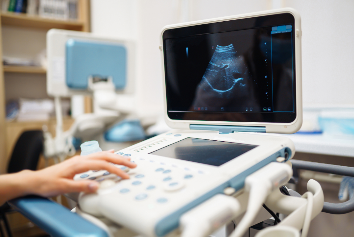 Perangkat USG dengan gambar janin yang terlihat di layar selama pemeriksaan kehamilan.